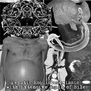 Lymphatic Filariasis - Hepatic Esquistosomiasis with Extensive Drain of Bil ...