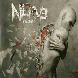 Nerve  - Fracture