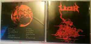 Ulcer  - Ulcer