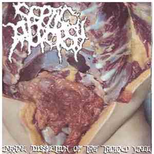Septic Autopsy, Infester  - Carnal Dissection Of The Thoraco Wall / Hidden  ...