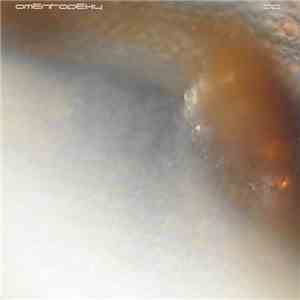 Siegmar Fricke - Omentopexy