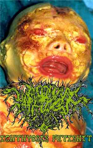 Vomithanatophorichthyosis - Ichthyosis Fetishit
