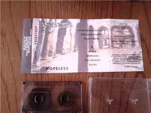 Anestesia  - Hopeless