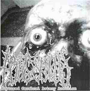 Active Stenosis / Pissdeads - Ruptured Cerebral Artery Aneurism / Untitled
