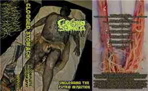Clogged Stomach - Unclogging The Putrid Impaction