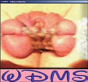 WDMS - Rolling Cartilage E.P.