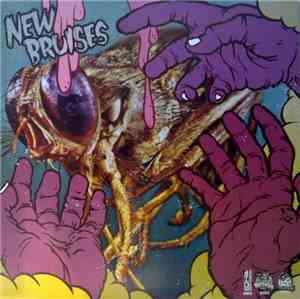 New Bruises / Stolen Bikes Ride Faster - New Bruises / Stolen Bikes Ride Fa ...