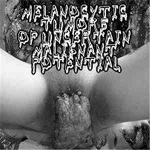 Melanocytic Tumors Of Uncertain Malignant Potential - S/t