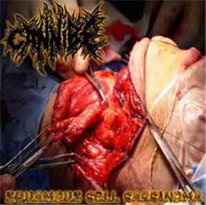Cannibe - Squamous Cell Carcinoma