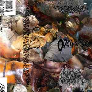 Trabecular Hepatocellular Carcinoma, Oozing Pus, Human Pancake - Trabecular ...