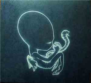 Sigur Rós - Ágætis Byrjun