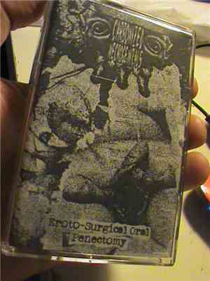 Carbonized Necrogenitals - Eroto-Surgical Oral Penectomy