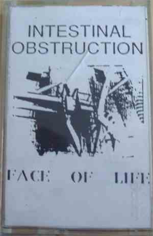 Intestinal Obstruction - Face Of Life