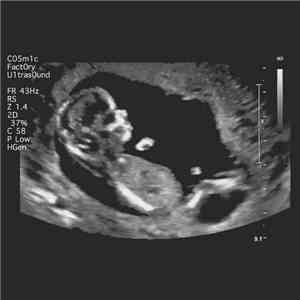 The Cosmic Factory - Ultrasound