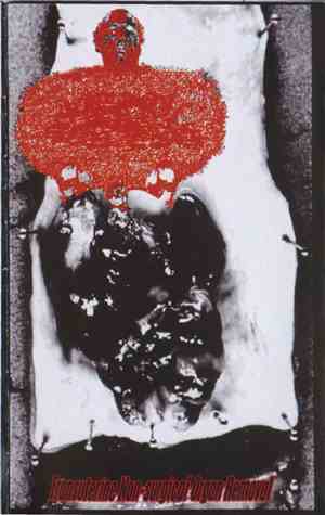 Urinary Tract Infection From Severe Pus Clots - Transuterine Non-Surgical Organ Removal