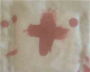 Skin Network - Severe Lacerations