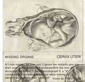 Missing Organs - Cervix Uteri