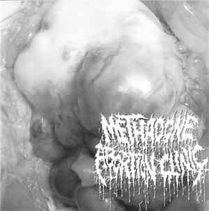 Methadone Abortion Clinic / Stoma - Methadone Abortion Clinic / Rectal Cran ...