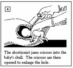 The Abortionist - Abortionist EP