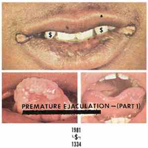 Premature Ejaculation - Part 1