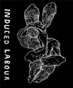 Induced Labour - Induced Labour