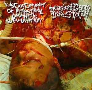 Malignant Germ Infestation, Disgorgement Of Intestinal Lymphatic Suppuratio ...