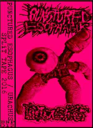 Punctured Esophagus / Urachus - Punctured Esophagus/Urachus